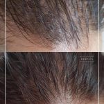 DORI SILVA MICROPIGMENTAÇÃO