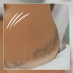 DORI SILVA MICROPIGMENTAÇÃO